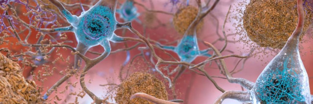 Photo source: National Institute on Aging, NIH Photo source: National Institute on Aging, NIH