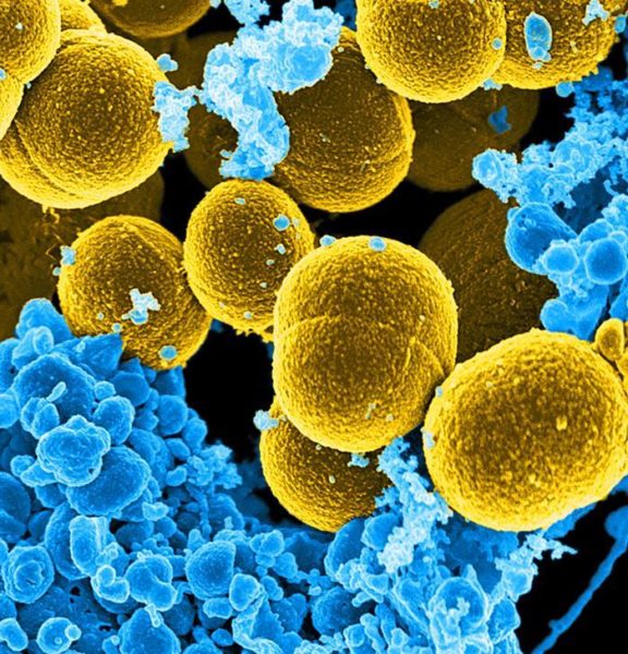 Methicillin-resistant Staphylococcus aureus (MRSA) are strains of 