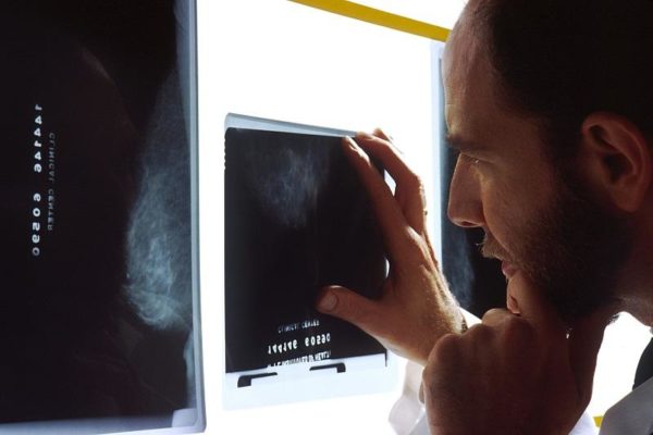 A physician examines a mammogram. Image credit: Bill Branson, National Cancer Institute