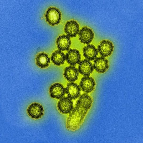 Influenza virus particles. Image credit: National Institute of Allergies and Infectious Diseases
