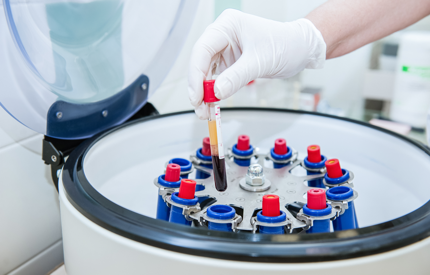 Follow That Blood Sample A Short Lab Tour