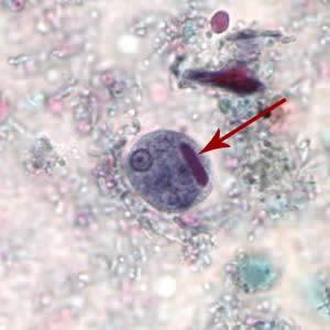 Entamoeba histolytica cyst. Image credit: CDC