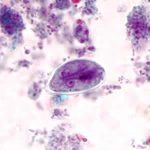 Giardia as seen under a microscope. Image credit: CDC