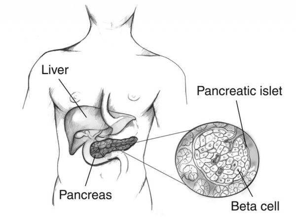 The pancreas with a close up of islet and beta cells. Image credit: NIDDK