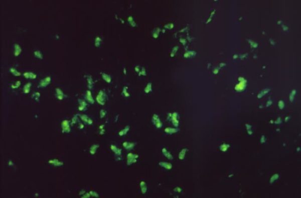Photo of fluorescent antibody stained sample showing several Toxoplasma parasites. Image credit: Dr. Sulzer, CDC