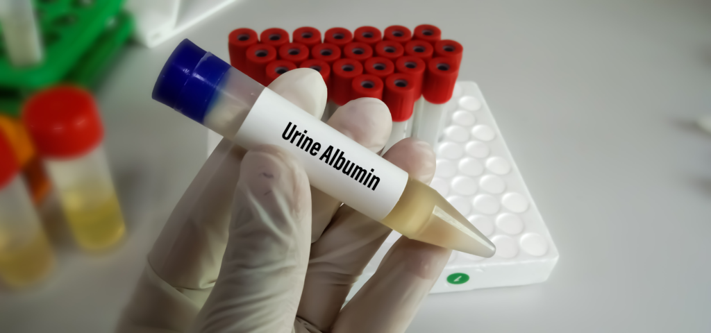 Urine albumin test