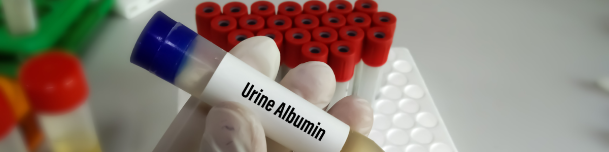 Urine albumin test