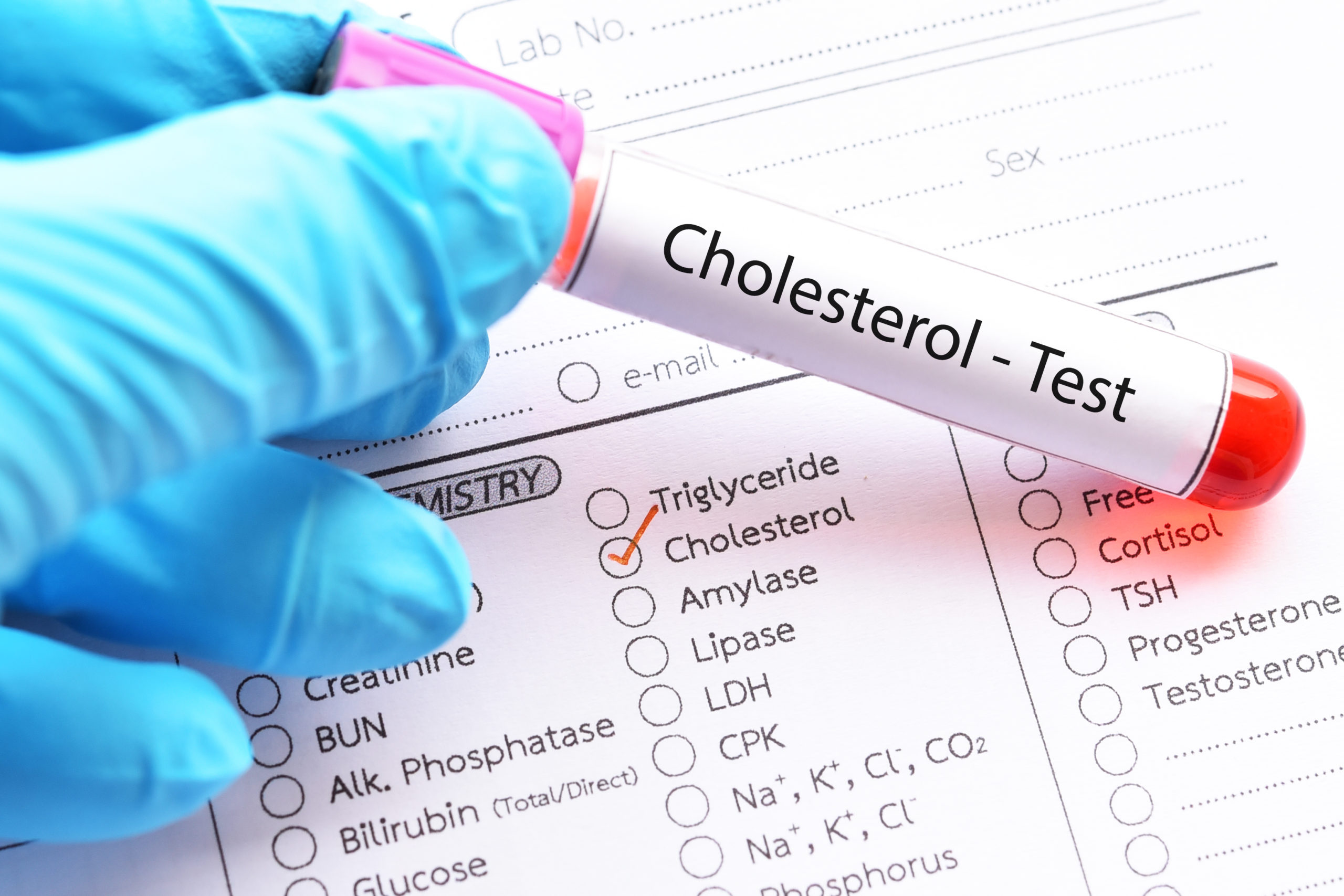 latest cholesterol research 2022