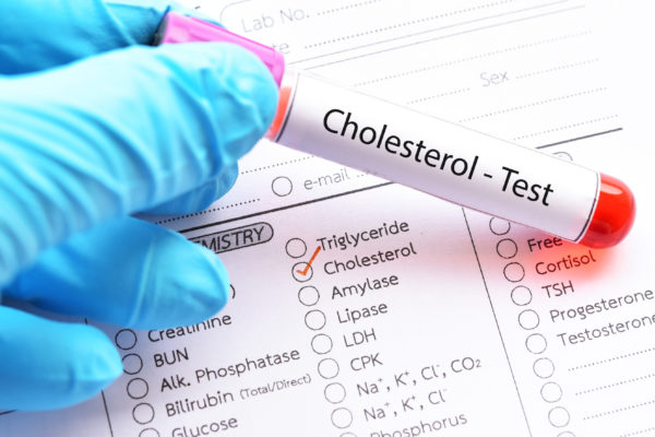 cholesterol test