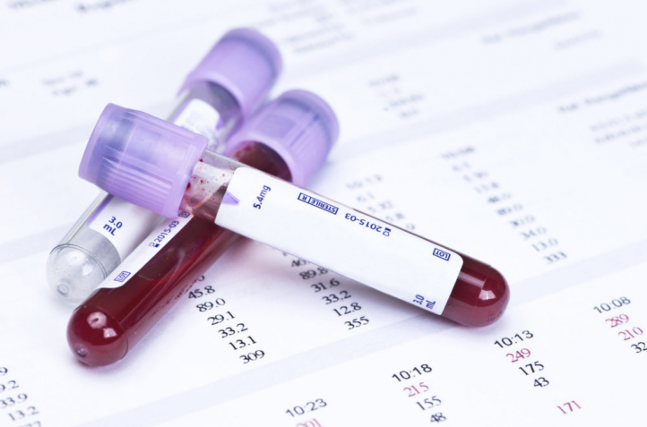 Hematology,Blood,Analysis,Report,With,Lavender,Color,Sample,Collection,Tubes. Reference Ranges Homepage Image